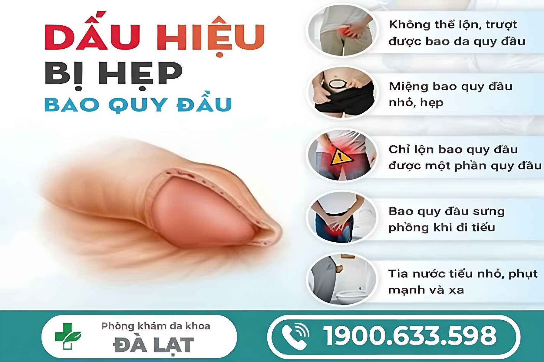 Hình ảnh minh họa